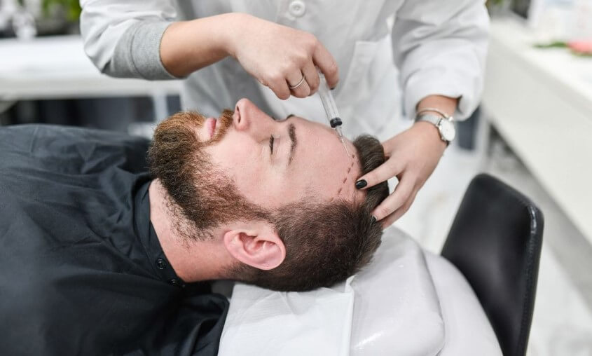 Fragen zur Haartransplantation - Nachteile